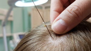 Close-up of a parent parting a child's hair to inspect a single lice egg cemented to a hair shaft