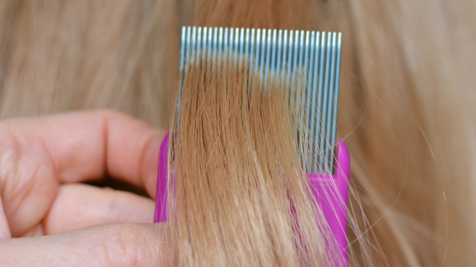 Close-up of a fine-tooth metal lice comb moving through hair to remove nits during treatment.