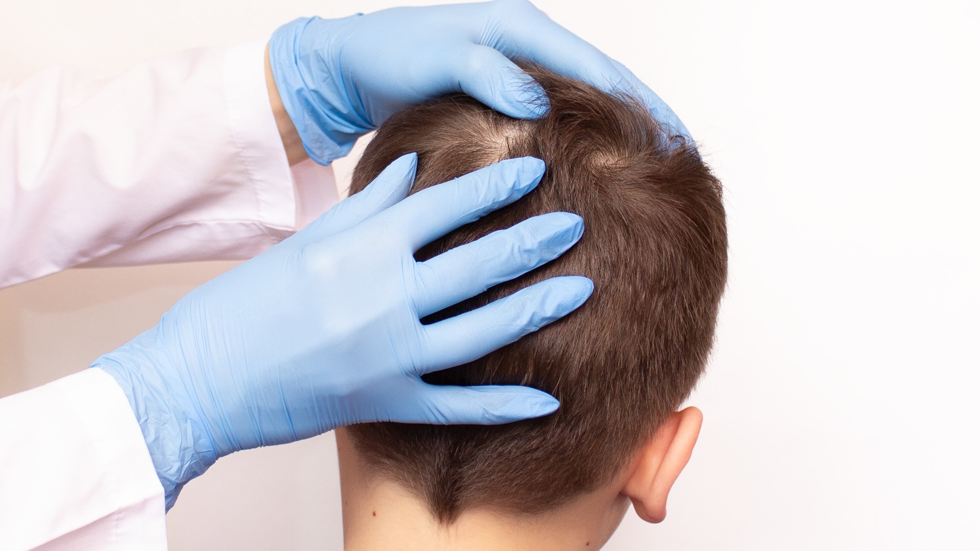Gloved hands checking the scalp and skin behind the ear for signs of irritation from untreated head lice.