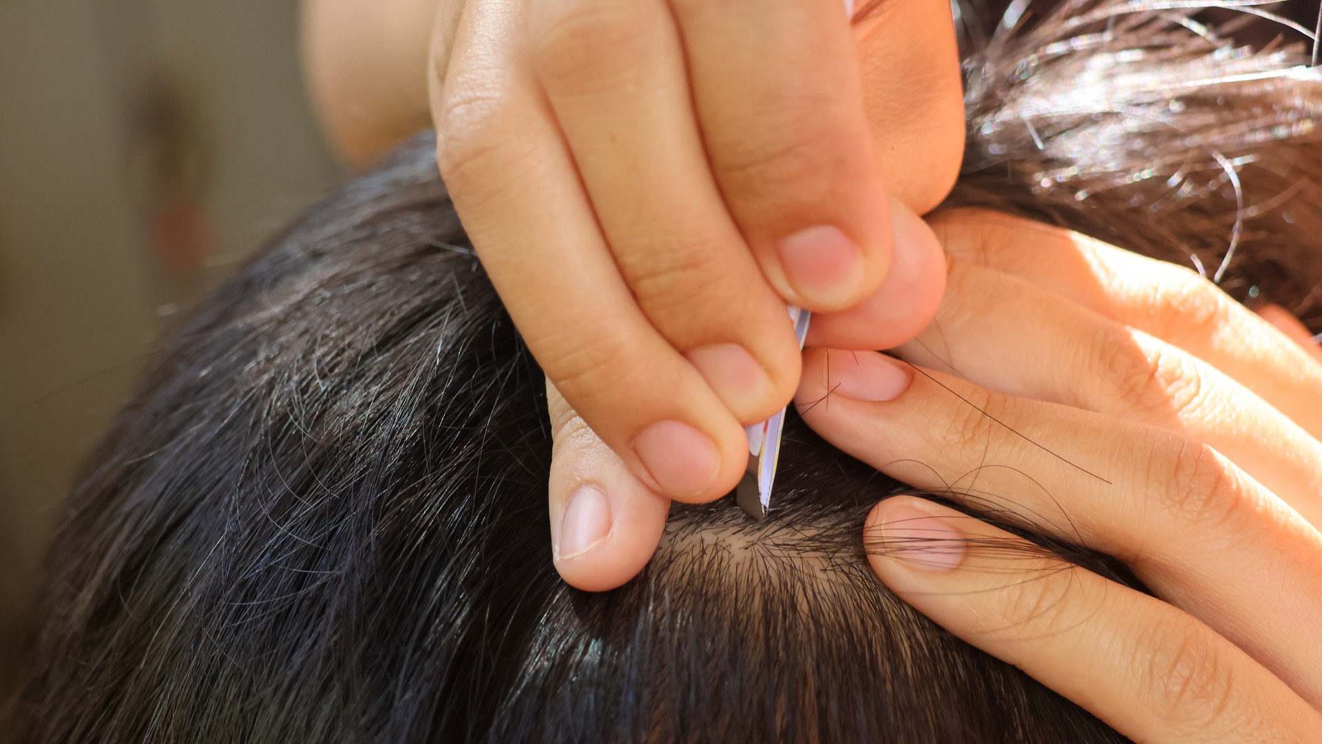 Beating Lice Once Won’t Make Your Child Immune