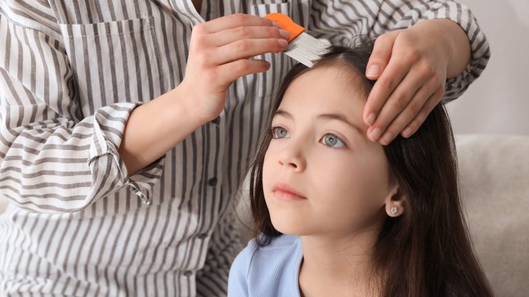 Check for Lice Before the Hairspray Goes On