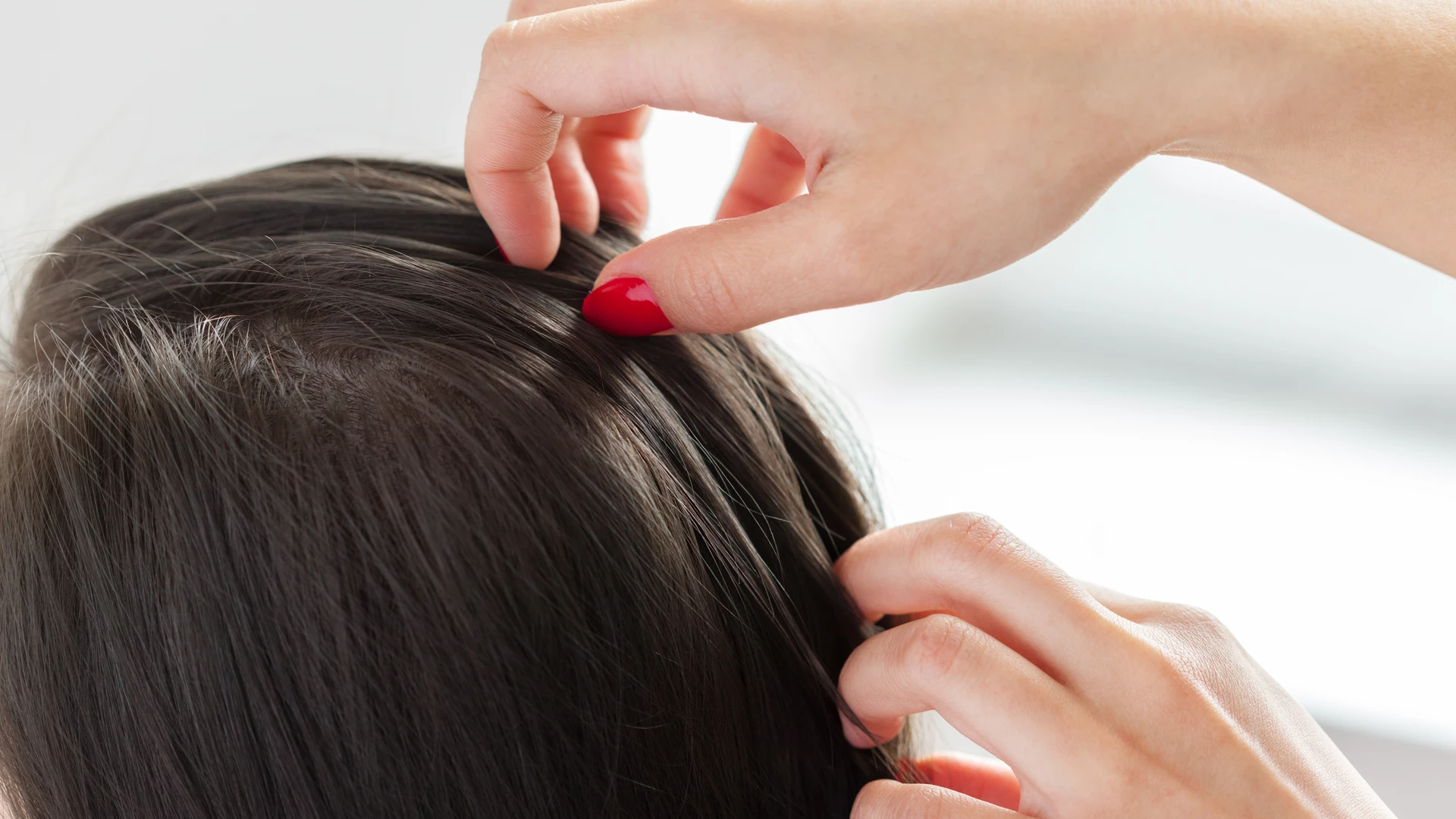 Hands parting dark hair at the crown to expose the scalp.