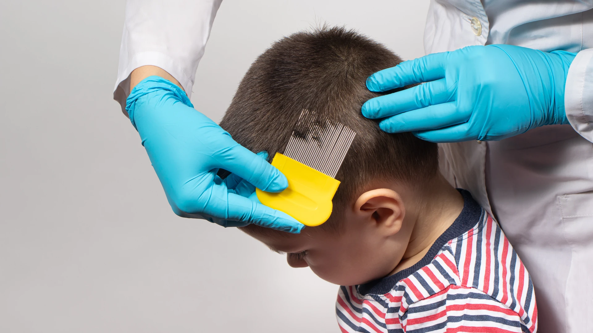 Gloved hands combing a child's short dark hair with a yellow-handled fine-tooth comb.